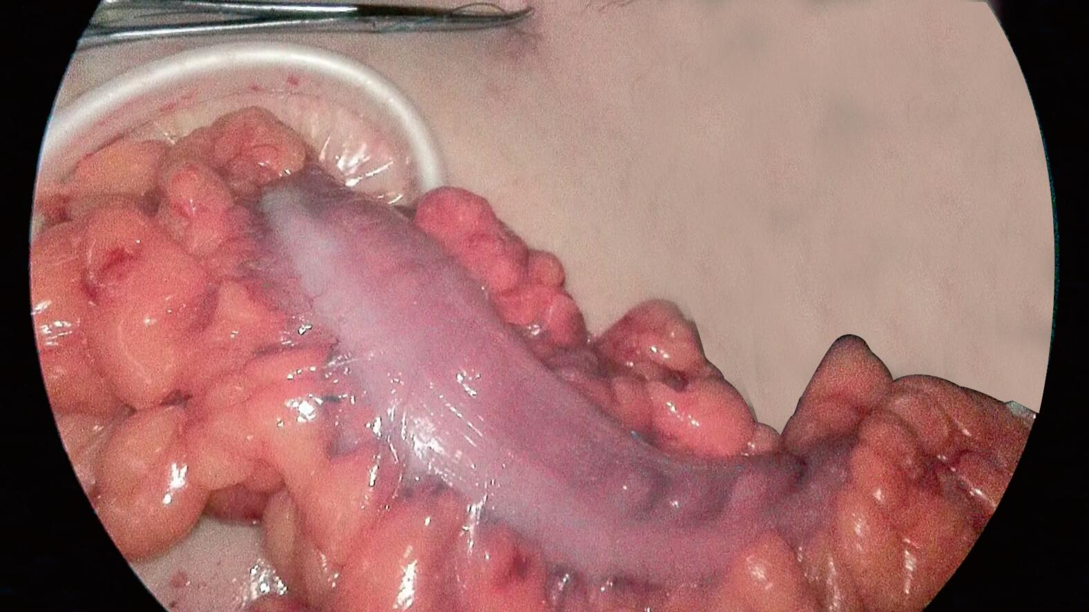 Assessment of the gastrointestinal anastomosis perfusion